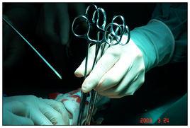 乳腺癌手術 乳腺癌手術