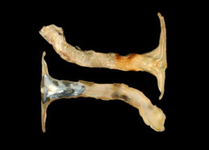 白丁蠣 Malleus albus