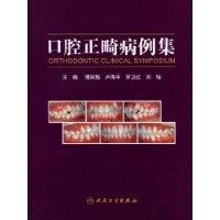 口腔正畸病例集 口腔正畸病例集