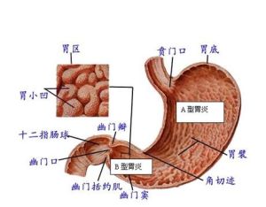 胃腸炎