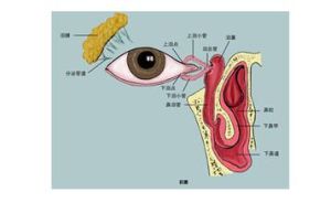 淚道阻塞 淚道阻塞