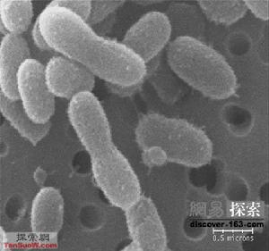 慢性嗜酸粒細胞性肺炎