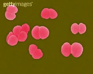 急性滲出性胸膜炎