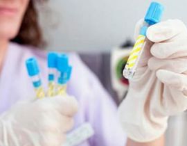 陰道清潔度 陰道清潔度