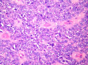 抗Sm抗體 抗Sm抗體