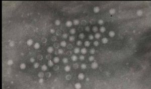 貓細小病毒 電子顯微鏡下觀看