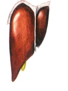 藥物性肝損傷 藥物性肝損傷