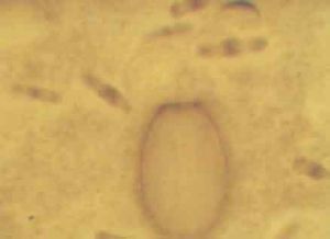 環孢子蟲病 環孢子蟲病