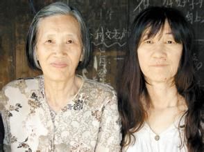 獲得性面部皮膚衰老症 獲得性面部皮膚衰老症