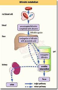 新生兒生理性黃疸
