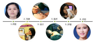 中山醫鼻亞單位綜合塑形術