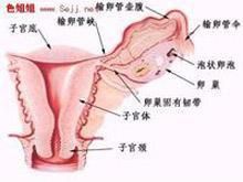 子宮收縮乏力 子宮收縮乏力