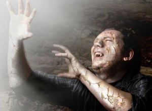 日光恐懼症 日光恐懼症