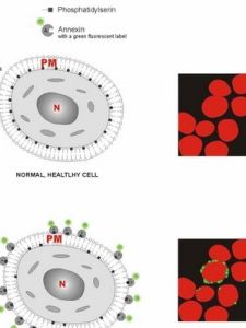 細胞凋亡 細胞凋亡