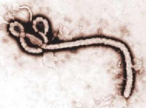 伊波拉病毒熱