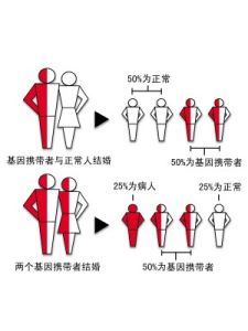 地中海貧血基因 地中海貧血基因