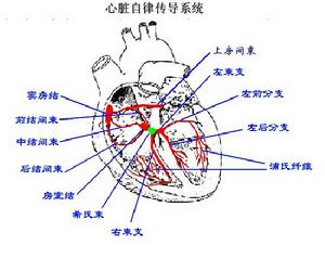 心性猝死綜合徵