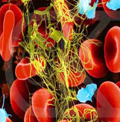 出血性血小板增多症