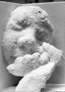 貝莉在娘胎中7個月大時的塑像模型。