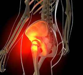 屁股疼痛 屁股疼痛