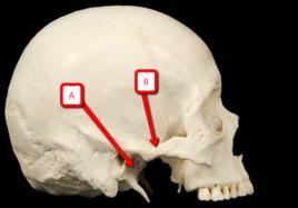 顴骨下頜窩 顴骨下頜窩