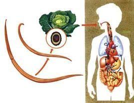 腸蛔蟲症 腸蛔蟲症