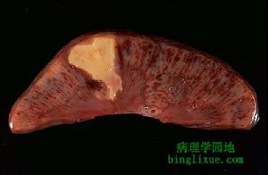 肝細胞凋亡 肝細胞凋亡