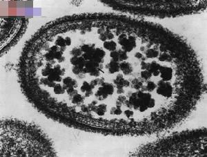 奈瑟菌屬 奈瑟菌屬