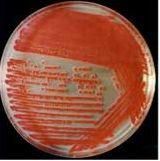 粘質沙雷氏菌 粘質沙雷氏菌