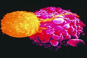成人T細胞淋巴瘤