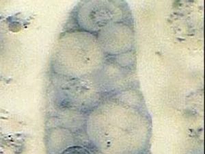 棘阿米巴蟲 棘阿米巴蟲