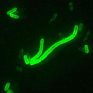 （圖）耶爾森氏菌病