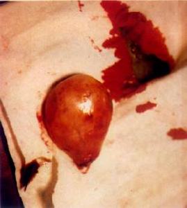 臨床雷射治療學