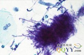 液基細胞學檢查