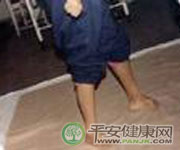 遺傳性共濟失調