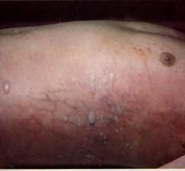 屍體現象 屍體現象