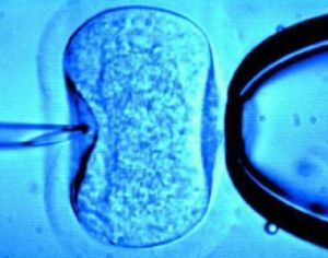 核蛋白移植技術 核蛋白移植技術