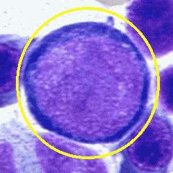 原巨紅細胞 原巨紅細胞