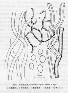 木質擬層孔 木質擬層孔