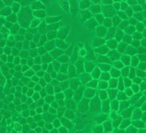 HeLa[生物學用語-宮頸癌細胞系]