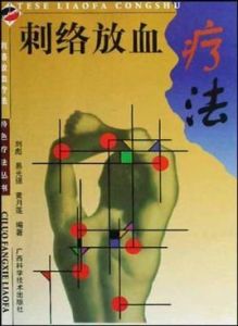 刺絡放血療法 刺絡放血療法