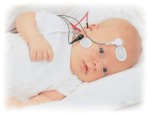 聽性腦幹反應 聽性腦幹反應