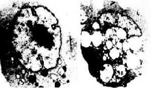（圖）海洋污染生物效應