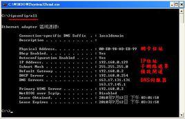 IP CONFIG TLW IP CONFIG TLW