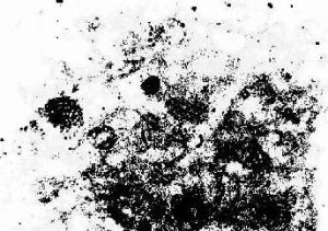 原位雜交術 原位雜交術