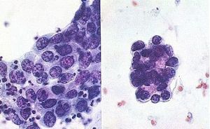 細胞學檢查 細胞學檢查