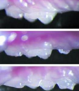 生物工程牙 生物工程牙