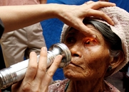 眼科診法