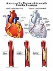 老年人糖尿病性心臟病 老年人糖尿病性心臟病
