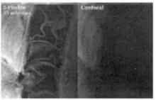 雙光子與共聚焦成像比較